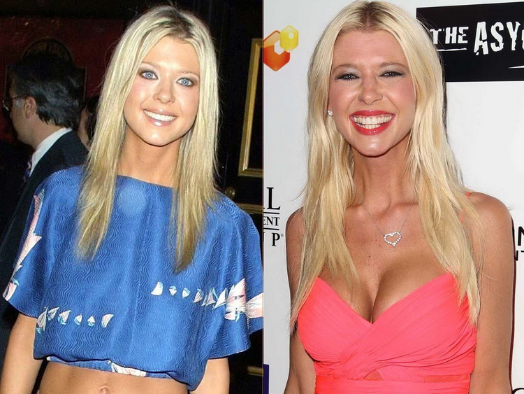 Tara Reid